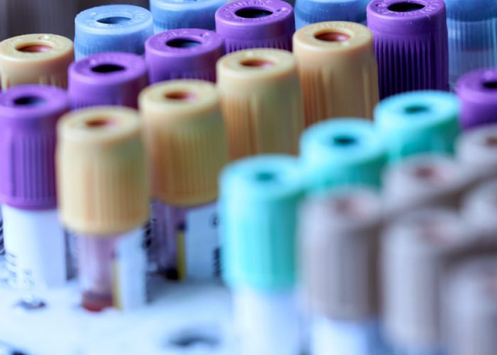 Preparing for a Pandemic